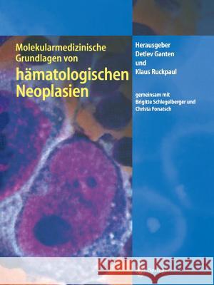 Molekularmedizinische Grundlagen Von Hämatologischen Neoplasien Ruckpaul, Klaus 9783642639418 Springer