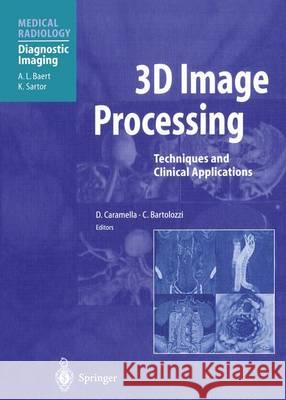 3D Image Processing: Techniques and Clinical Applications A.L. Baert, D. Caramella, C. Bartolozzi 9783642639777