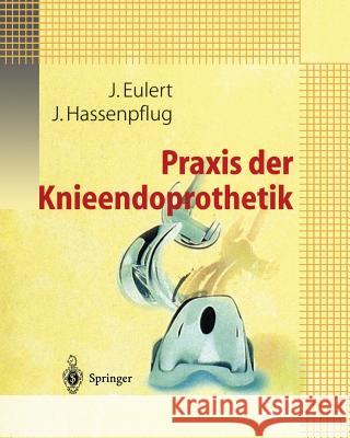 Praxis Der Knieendoprothetik Eulert, J. 9783642640063 Springer