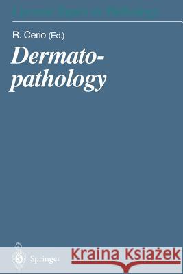 Dermatopathology R. Cerio 9783642640247 Springer-Verlag Berlin and Heidelberg GmbH & 