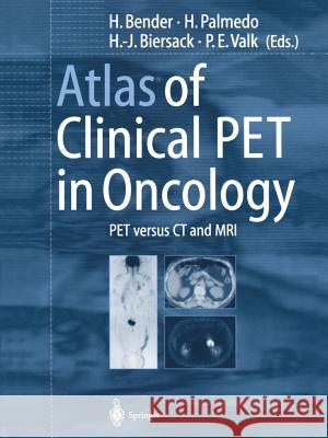 Atlas of Clinical Pet in Oncology: Pet Versus CT and MRI Bender, H. 9783642640933 Springer