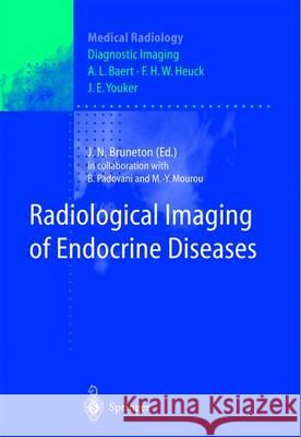 Radiological Imaging of Endocrine Diseases J. N. Bruneton N. Rameau-Reed A. L. Baert 9783642642005 Springer