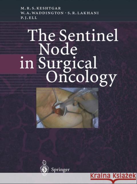 The Sentinel Node in Surgical Oncology Mohammad R. S. Keshtgar Wendy A. Waddington Sunil R. Lakhani 9783642642302 Springer