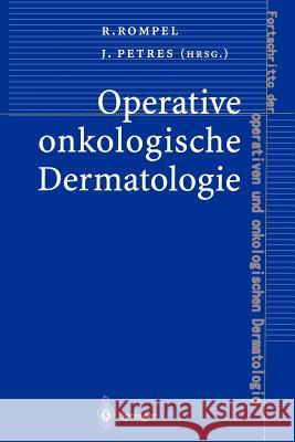Operative Onkologische Dermatologie Rainer Rompel Johannes Petres 9783642642333 Springer