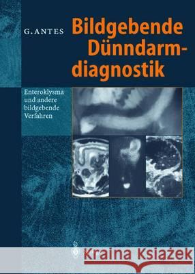 Bildgebende Dünndarmdiagnostik: Enteroklysma Und Andere Bildgebende Verfahren Antes, Günther 9783642643460