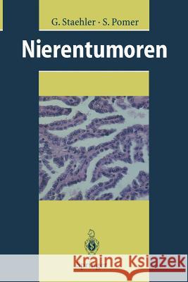 Nierentumoren: Grundlagen, Diagnostik, Therapie Staehler, G. 9783642643576 Springer