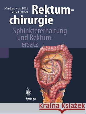 Rektumchirurgie: Sphinktererhaltung Und Rektumersatz Beglinger, C. 9783642644443 Springer