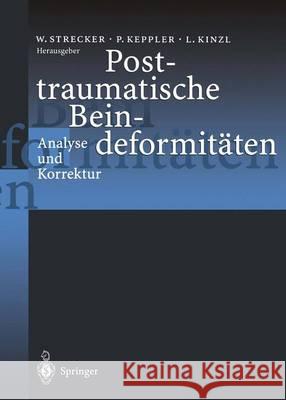 Posttraumatische Beindeformitäten: Analyse Und Korrektur Strecker, Wolf 9783642645297 Springer