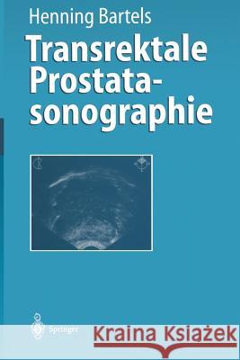 Transrektale Prostatasonographie Henning Bartels 9783642647284 Springer