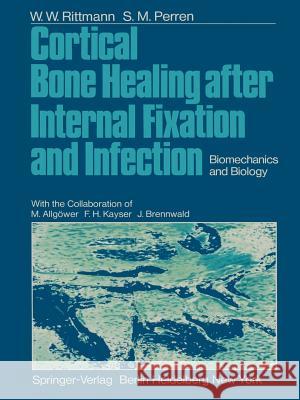 Cortical Bone Healing After Internal Fixation and Infection: Biomechanics and Biology Allgöwer, M. 9783642659799