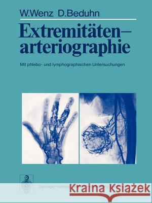 Extremitätenarteriographie: Mit Phlebo- Und Lymphographischen Untersuchungen Wenz, W. 9783642661709 Springer