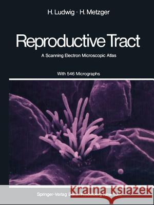 The Human Female Reproductive Tract: A Scanning Electron Microscopic Atlas Ludwig, H. 9783642663475 Springer