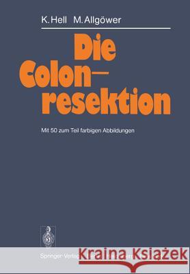 Die Colonresektion K. Hell M. All 9783642664106 Springer