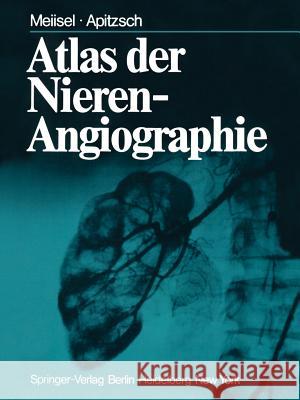 Atlas Der Nierenangiographie Laasonen, L. 9783642667909 Springer