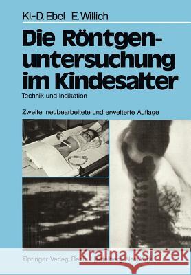 Die Röntgenuntersuchung Im Kindesalter: Technik Und Indikation Schulz, R. D. 9783642670329 Springer