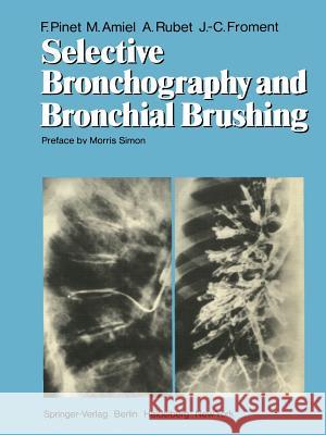 Selective Bronchography and Bronchial Brushing F. Pinet M. Amiel A. Rubet 9783642671302 Springer