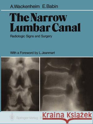 The Narrow Lumbar Canal: Radiologic Signs and Surgery Wackenheim, A. 9783642673498 Springer