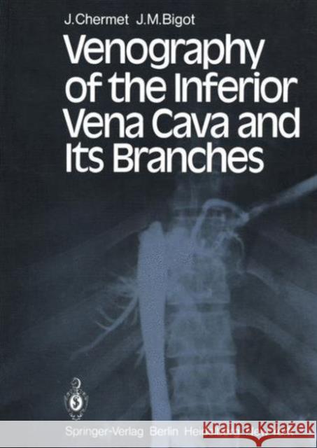 Venography of the Inferior Vena Cava and Its Branches J. Chermet J. M. Bigot M. T. Wackenheim 9783642675812 Springer