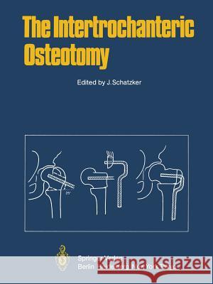 The Intertrochanteric Osteotomy J. Schatzker J. Aronson R. Bombelli 9783642680540 Springer