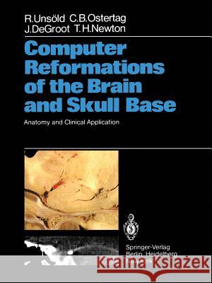 Computer Reformations of the Brain and Skull Base: Anatomy and Clinical Application Unsöld, R. 9783642685989 Springer