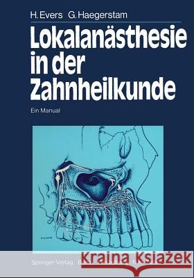 Lokalanästhesie in Der Zahnheilkunde: Ein Manual Evers, H. 9783642687761 Springer