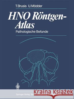 HNO Röntgen-Atlas: Pathologische Befunde Tilman Brusis, Ulrich Mödder, G. Friedmann 9783642692420