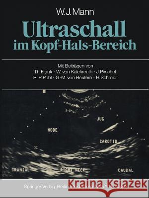 Ultraschall Im Kopf-Hals-Bereich Frank, T. 9783642692840 Springer