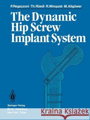 The Dynamic Hip Screw Implant System P. Regazzoni T. R R. Winquist 9783642699276 Springer