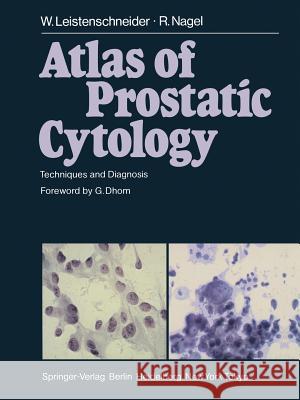 Atlas of Prostatic Cytology: Techniques and Diagnosis Leistenschneider, W. 9783642701122 Springer