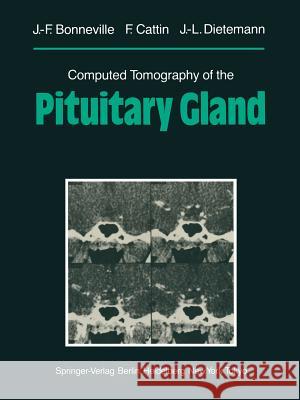 Computed Tomography of the Pituitary Gland: With a Chapter on Magnetic Resonance Imaging of the Sellar and Juxtasellar Region, by M. Mu Huo Teng and K Mu Huo Teng, M. 9783642703775 Springer