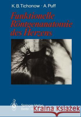 Funktionelle Röntgenanatomie Des Herzens Tichonow, Konstantin B. 9783642704482 Springer