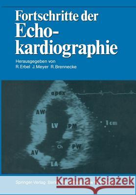 Fortschritte Der Echokardiographie Erbel, Raimund 9783642705656 Springer
