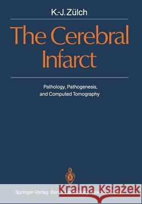 The Cerebral Infarct: Pathology, Pathogenesis, and Computed Tomography K.-J. Zülch 9783642707674 Springer-Verlag Berlin and Heidelberg GmbH & 