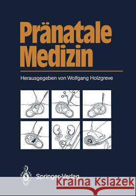 Pränatale Medizin Beller, Frauke 9783642710490 Springer