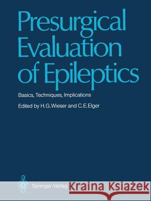 Presurgical Evaluation of Epileptics: Basics, Techniques, Implications Wieser, Heinz G. 9783642711053 Springer