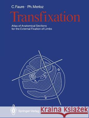 Transfixation: Atlas of Anatomical Sections for the External Fixation of Limbs Faure, Claude 9783642716218 Springer