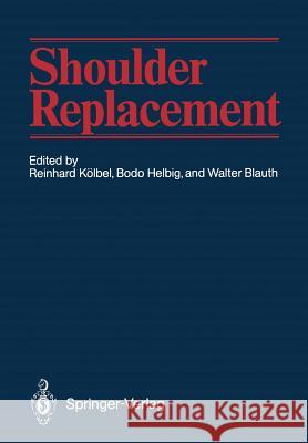 Shoulder Replacement Reinhard K Bodo Helbig Walter Blauth 9783642716270