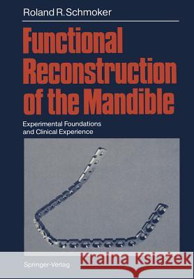 Functional Reconstruction of the Mandible: Experimental Foundations and Clinical Experience Müller, M. E. 9783642717581 Springer