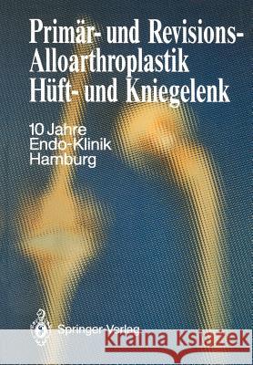 Primär- Und Revisions-Alloarthroplastik Hüft- Und Kniegelenk: 10 Jahre Endo-Klinik Hamburg Endo-Klinik 9783642718335