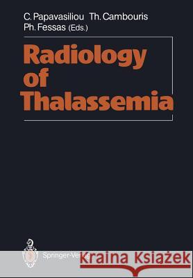 Radiology of Thalassemia Constantin Papavasiliou Theophanis Cambouris Phaedon Fessas 9783642725890 Springer