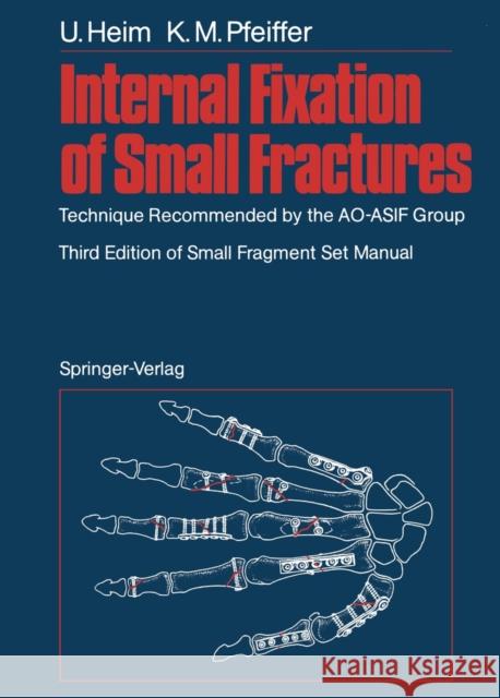 Internal Fixation of Small Fractures: Technique Recommended by the Ao-Asif Group Oberli, K. 9783642726163 Springer