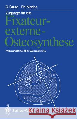 Zugänge Für Die Fixateur-Externe-Osteosynthese: Atlas Anatomischer Querschnitte Faure, Claude 9783642726279 Springer