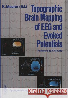 Topographic Brain Mapping of Eeg and Evoked Potentials Duffy, F. H. 9783642726606 Springer
