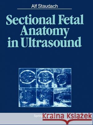 Sectional Fetal Anatomy in Ultrasound Alf Staudach Terry Telger W. Thiel 9783642729188