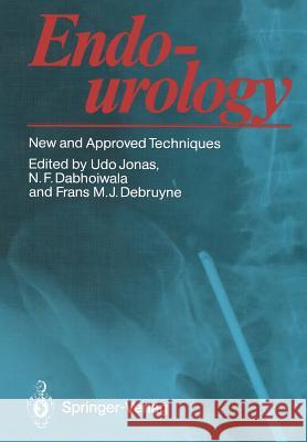 Endourology: New and Approved Techniques Jonas, Udo 9783642730313 Springer