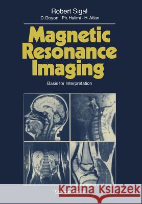 Magnetic Resonance Imaging: Basis for Interpretation Assenat, S. 9783642730399 Springer