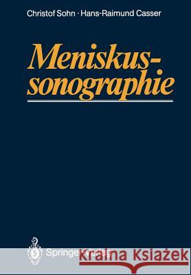 Meniskussonographie Christof Sohn Hans-Raimund Casser 9783642733796 Springer