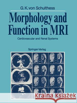 Morphology and Function in MRI: Cardiovascular and Renal Systems Fuchs, W. a. 9783642735189 Springer