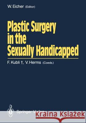 Plastic Surgery in the Sexually Handicapped Wolf Eicher 9783642735677 Springer