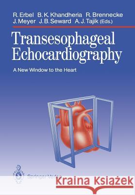 Transesophageal Echocardiography: A New Window to the Heart Erbel, Raimund 9783642742590